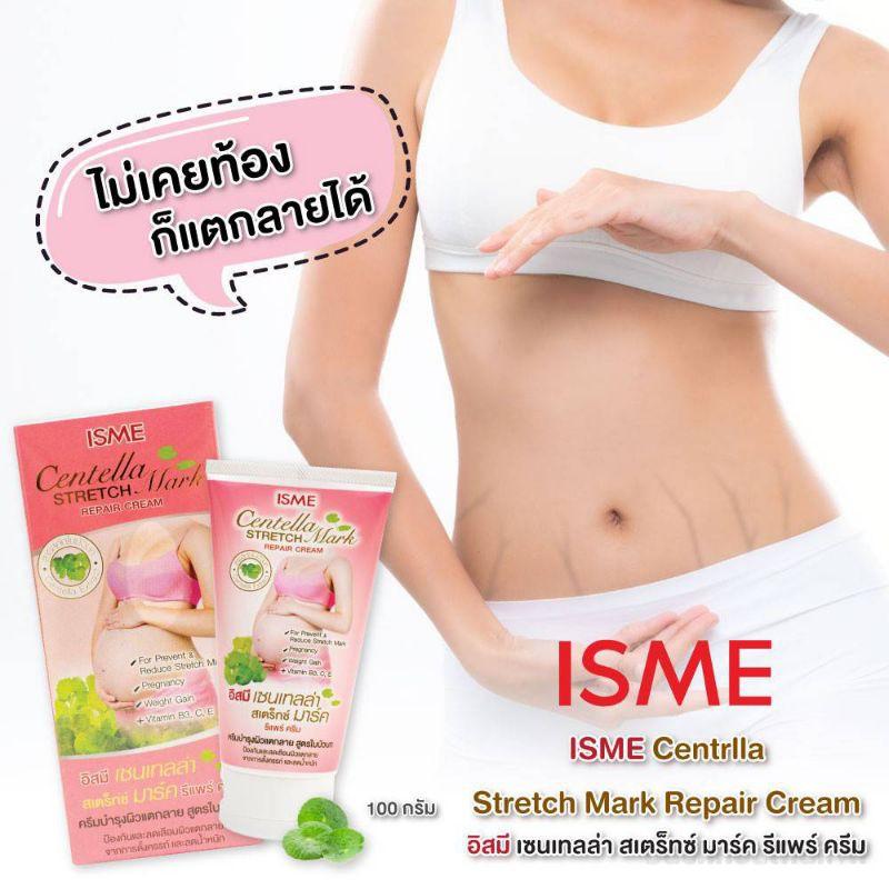 Kem xóa rạn da ISME Centella Stretch Mark Repair Cream