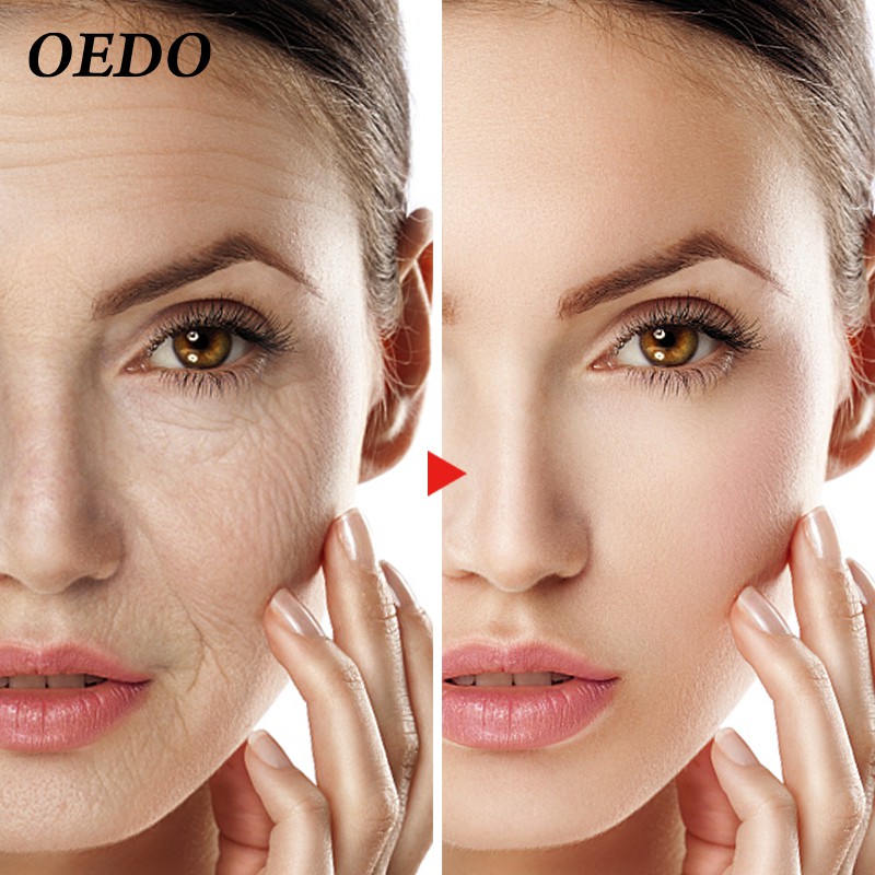 Huyết Thanh Dưỡng Ẩm OEDO Vàng Axit Hyaluronic Thu Nhỏ Lỗ Chân Lông Loại Bỏ Vết Tàn Nhang Làm Trắng Da Chống Lão Hóa Tinh Chất Dưỡng Da 7.5ml