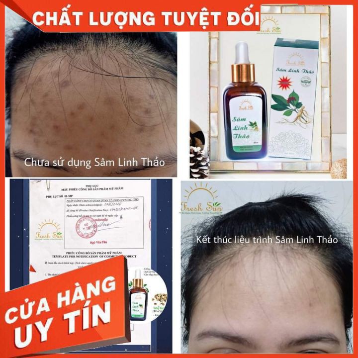 Sâm Linh Thảo [CHÍNH HÃNG] 💞 Đánh bay các loại MỤN, nám, tàn nhang