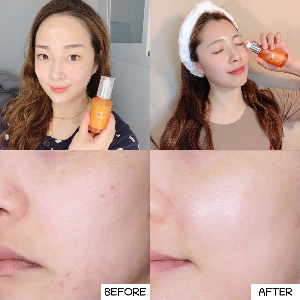 Tinh Chất Giảm Mụn, Dưỡng Sáng Da Chống Lão Hoá AprilSkin Serum