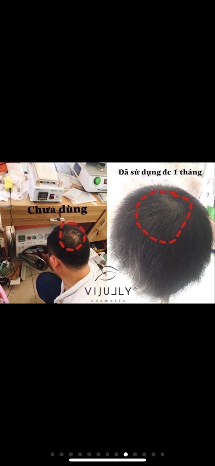 [Tặng 1 mask khổ qua 🎁 ] Tinh Dầu Bưởi kích mọc tóc Vi Jully | BigBuy360 - bigbuy360.vn