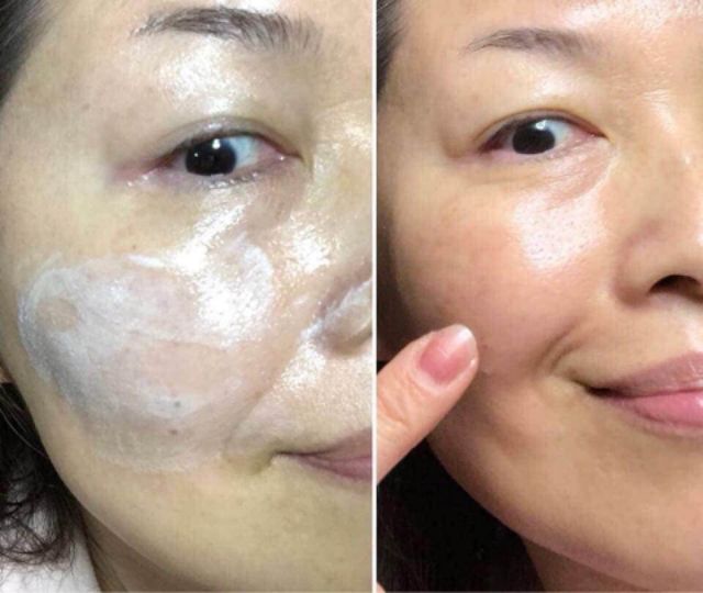 [Mã COS1904 giảm 8% đơn 300K] Kem Mess Civasan tái sinh thần tốc cho da mỏng yếu nhạy cảm 10g, 35g | BigBuy360 - bigbuy360.vn