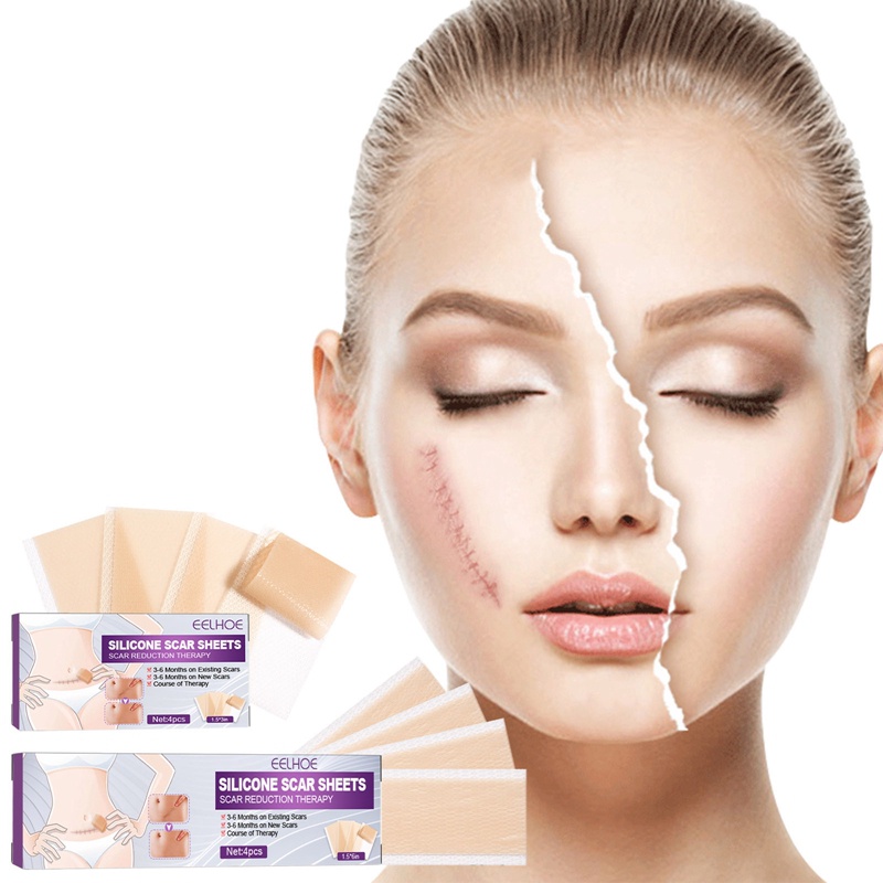Miếng Dán Silicone Làm Mờ Sẹo Phẫu Thuật Tiện Dụng Mới
