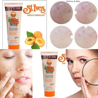 Gel tẩy tế bào chết stives hương mơ 212ml