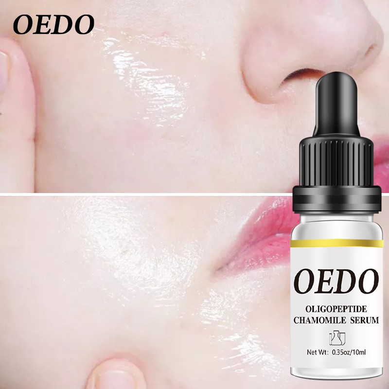 Oligopeptide Chamomile Serum OEDO Làm dịu và Phục hồi Chống nhăn Dưỡng ẩm Chăm sóc Chuyên sâu Cho Mặt 10ml