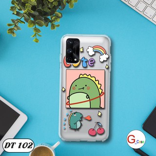Ốp lưng dẻo Realme X7 Pro