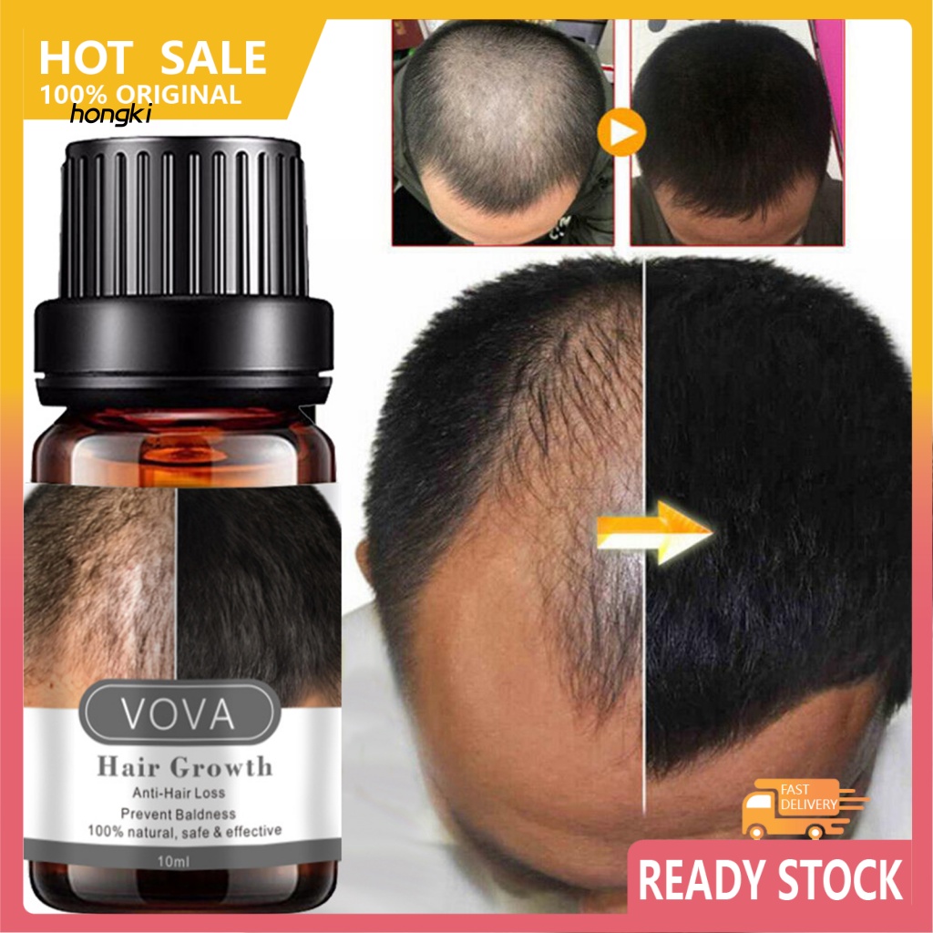 Tinh Chất Kích Thích Mọc Tóc Và Trị Hói Đầu 10ml