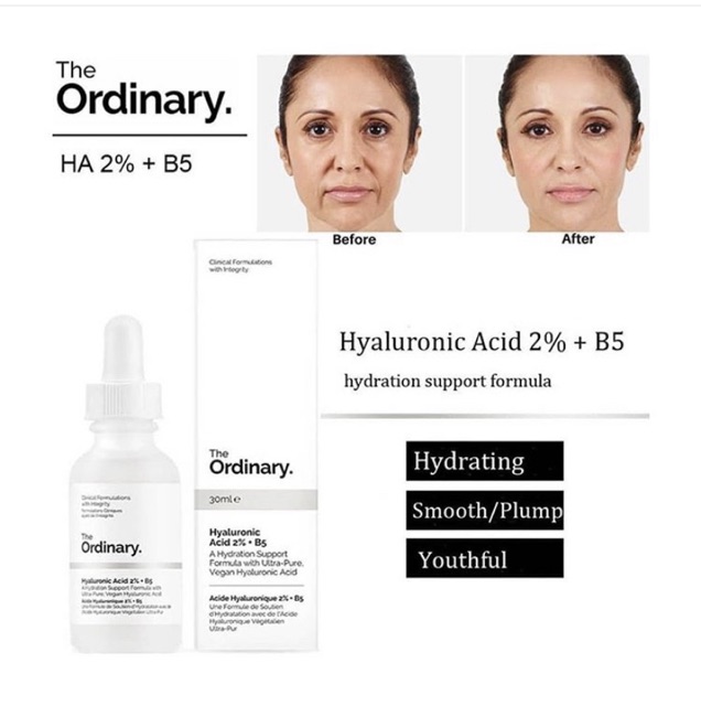Serum dưỡng da siêu cấp ẩm TO Hyaluronic Acid 2% + B5 30ml