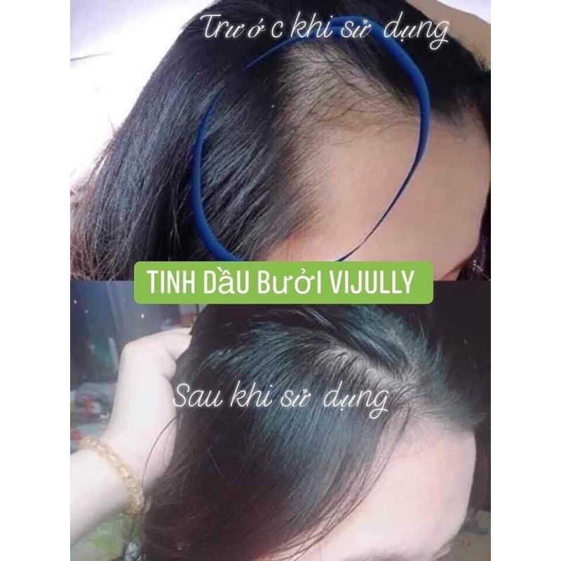 Tinh Dầu Bưởi VIJULLY [Kích Mọc Tóc] 100% Tự Nhiên | BigBuy360 - bigbuy360.vn