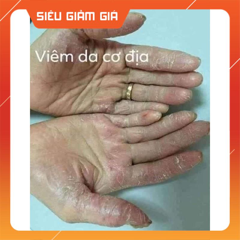 Kem bôi da kem bôi tổ đỉa ghẻ nước nấm ngứa các loại, thảo dược tự nhiên