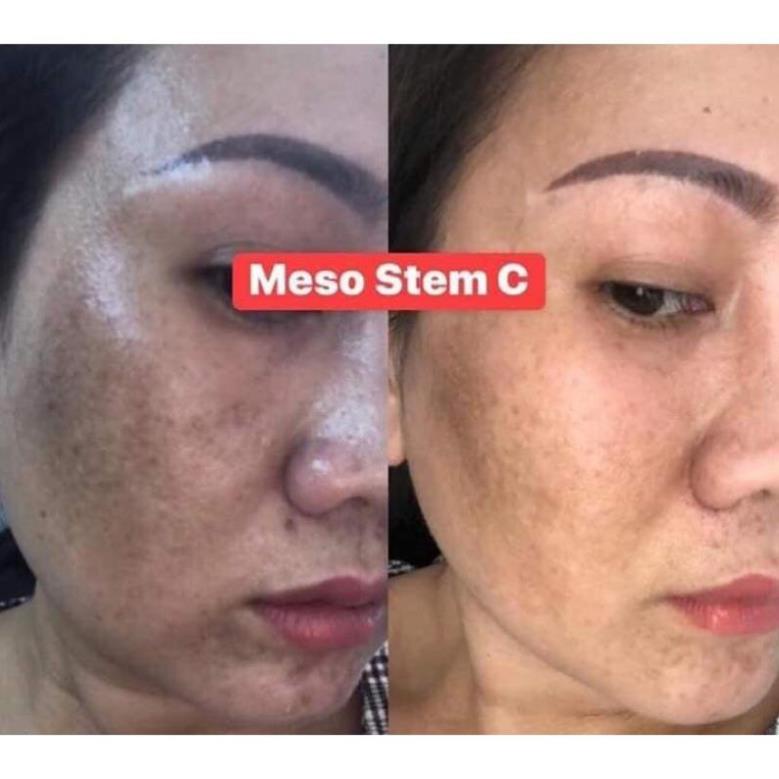 Meso Stem C Cream ISOV - Kem Tế Bào Gốc trắng da, mờ Nám