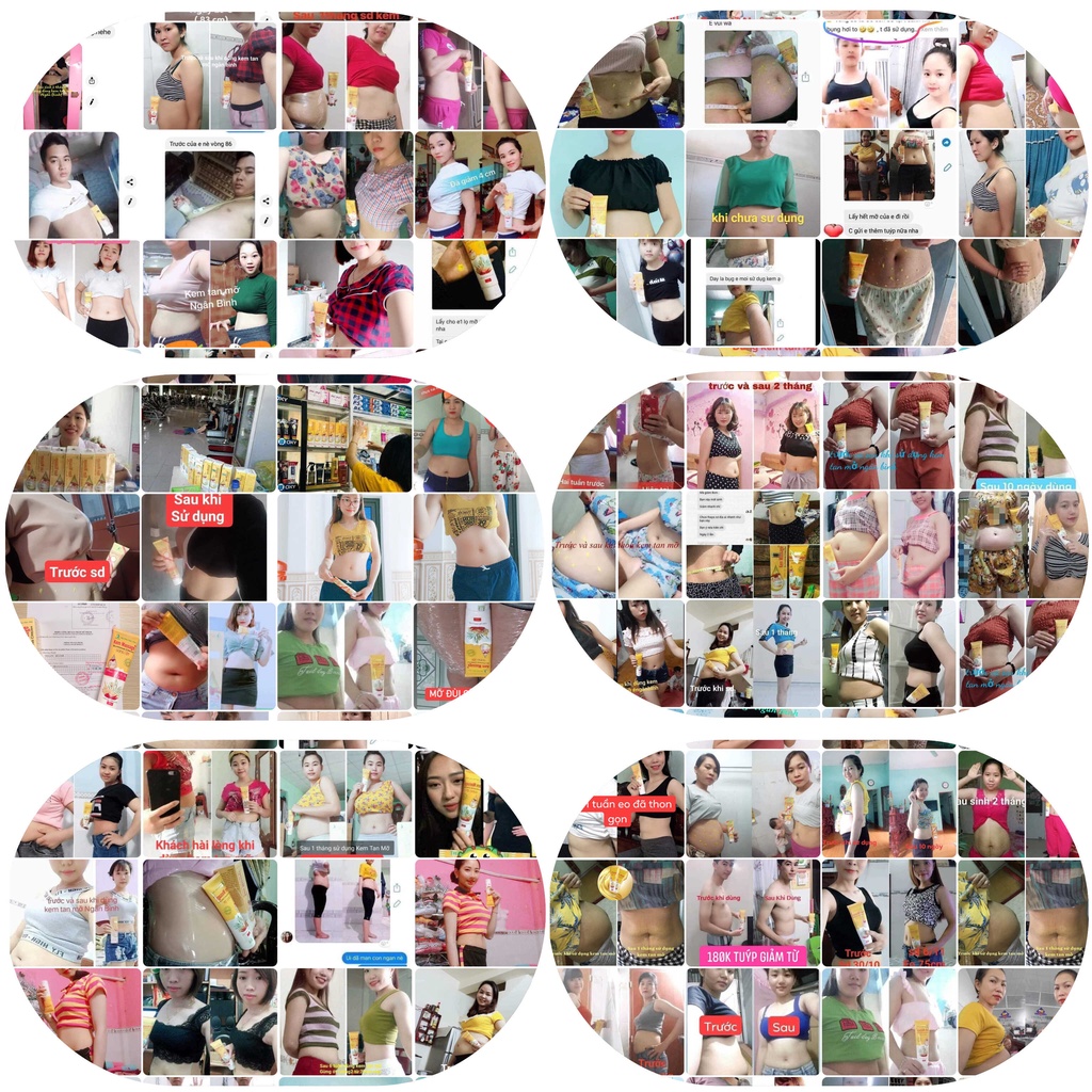 Kem massage tan mỡ gừng ớt Ngân Bình đánh tan mỡ bụng, săn chắc cơ mông, cơ đùi, giảm mỡ bắp tay.. Ngân Bình