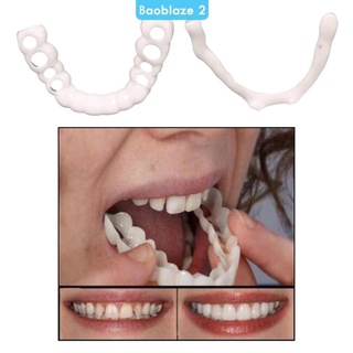 Veneers silicon mềm tạm thời giả trên