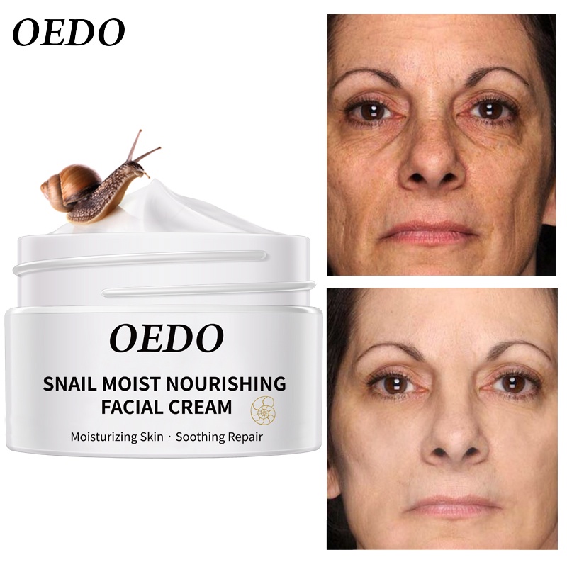 Set mỹ phẫm OEDO gồm sữa rửa mặt Amino Acid làm sạch sâu+kem dưỡng ẩm chống nếp nhăn+tinh chất thu nhỏ lỗ chân lông