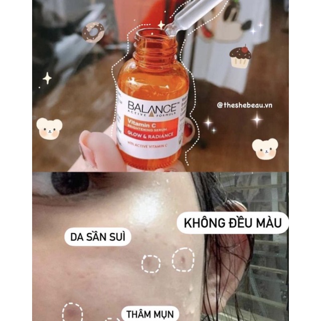 Serum làm mờ thâm và sáng da Balance Vtm C 30ml