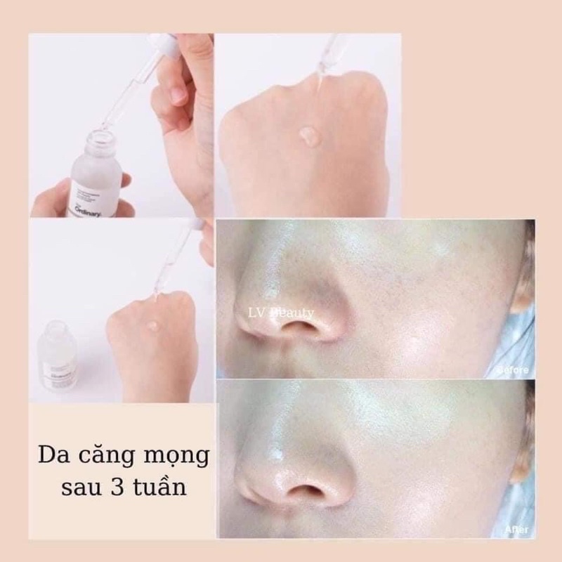 Bill US - Tinh chất dưỡng ẩm, phục hồi da The Ordinary HYALUNORIC 2% + B5 Serum