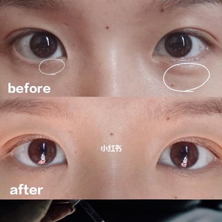 Serum Dưỡng Mắt The Ordinary Caffeine Solution 5% + EGCG Serum 30ml