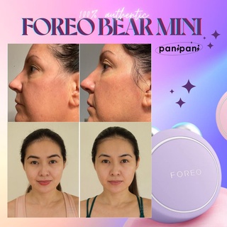 [100% AUTH][ HỖ TRỢ BẢO HÀNH] MÁY MASSAGE NÂNG CƠ MẶT F OREO BEAR MINI