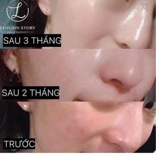 HỘP ĐỰNG 30 TÚI LỰU HÀN QUỐC
