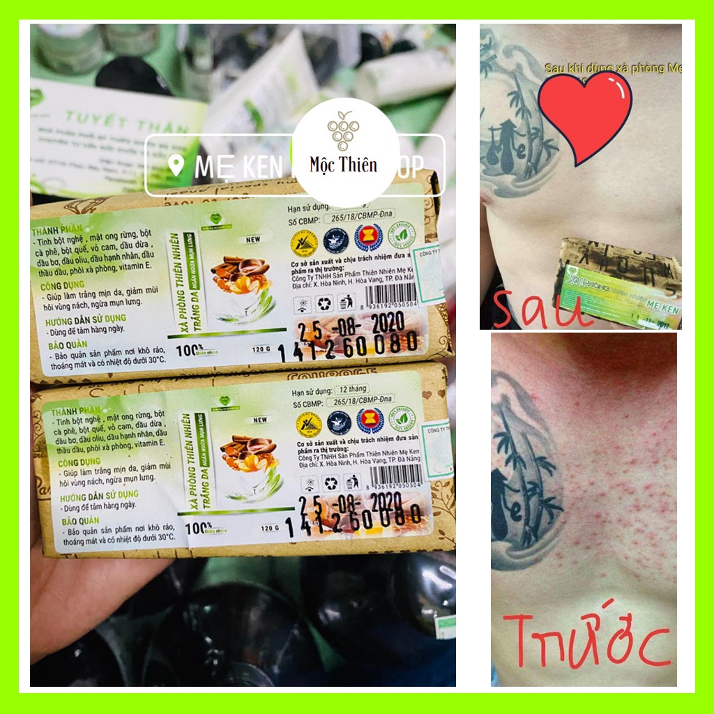 Xà Phòng Sạch Mụn Lưng Mẹ Ken 120gr - Cải Thiện Thâm Mông, Hôi Nách Và Trắng Da [Mộc Thiên] | BigBuy360 - bigbuy360.vn