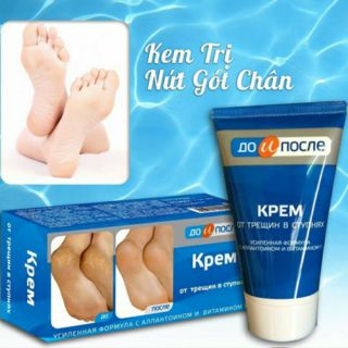Kem giảm Nứt Gót Chân Nga Apteka Kpem Vitamin E