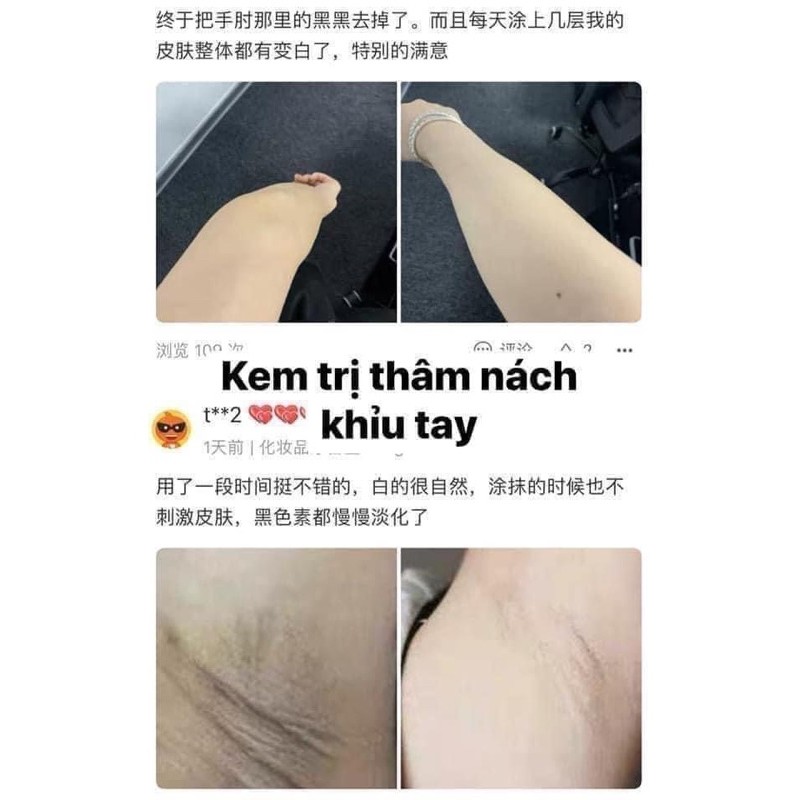 Kem PIBAMY Thải Độc Thâm Đầu Gối , Nách , Khuỷu Tay