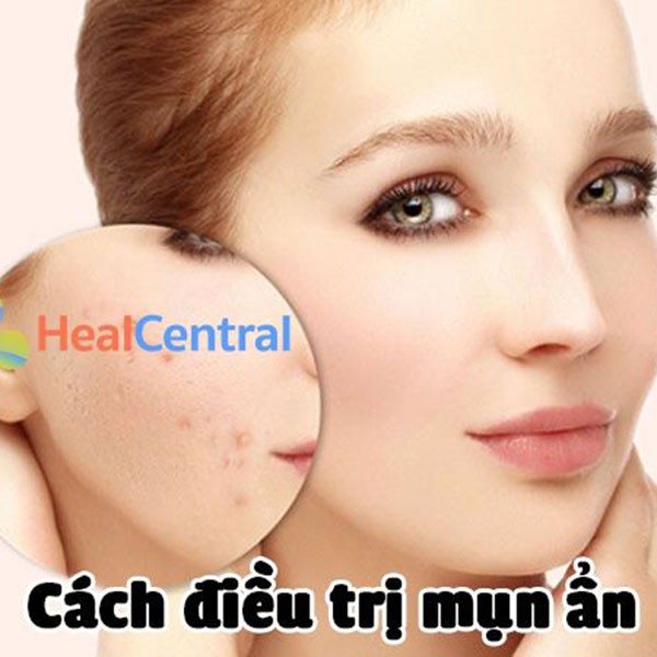 Kem Đêm hoàng cung Hồng Danxuenilan Cao cấp