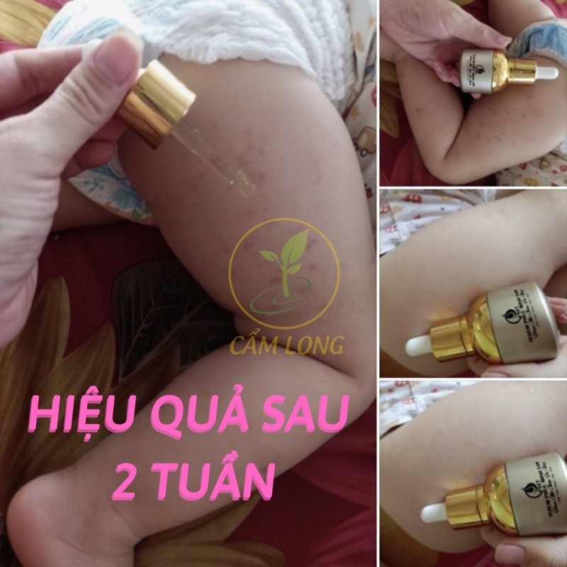Kem Giảm Mờ Thâm Đầu Gối Nách Môi Vùng Kín Bikini Sẹo PHÚC MINH TÂM MTPMTTD46 Dưỡng Ẩm Bổ Sung Dưỡng Chất Làm Mờ Thâm | BigBuy360 - bigbuy360.vn