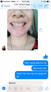 Kem đánh răng AP24