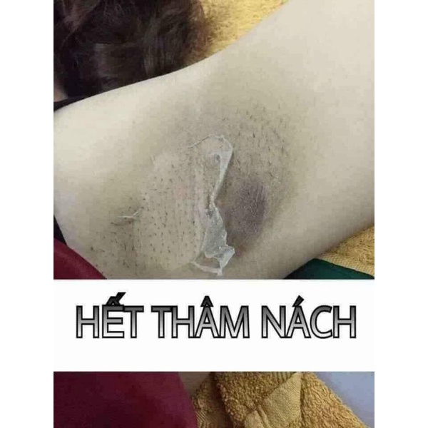 Peel Pink TCA Thâm Nách, Nhũ Hoa, Bikini - Làm Trắng Hồng Chuyên Dụng