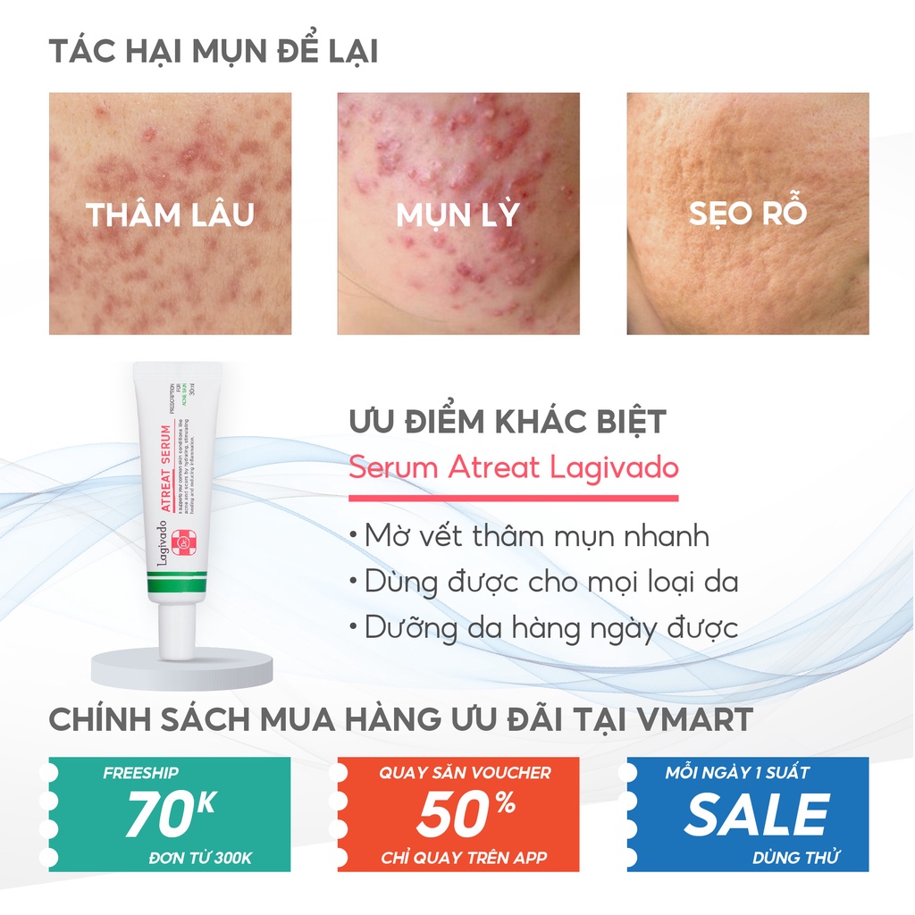 - Serum Atreat Lagivado 30ml - Giảm mụn thâm, ngừa sẹo rỗ - Vmart phân phối