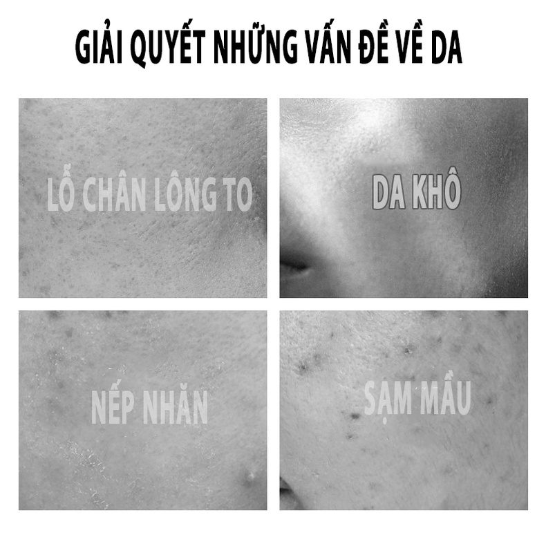 Mặt nạ trắng da dưỡng ẩm cấp ẩm mờ thâm giảm mụn kiềm dầu mask nội địa cao cấp ngũ cốc nội địa trung MOCCO OSMN001