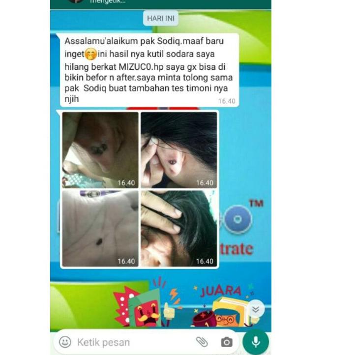 ⭐ Xịt Cố Định Mizuco (Bộ 139) (trims,.) | BigBuy360 - bigbuy360.vn