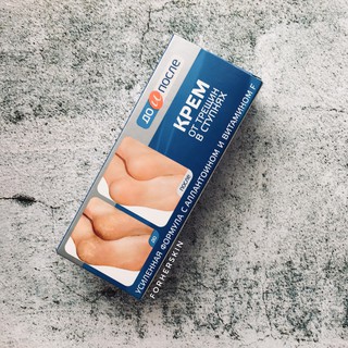Kem Trị Nứt Gót Chân Kpem (50ml)