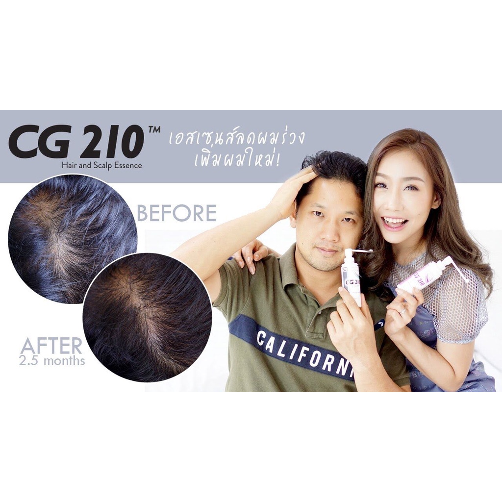 (ĐỌC KỸ MÔ TẢ) Tinh chất giảm rụng và kích mọc tóc cho Nam &amp; Nữ Abbott CG 210 Anti-Hair loss &amp; Scalp Essence 80ml (Pháp)