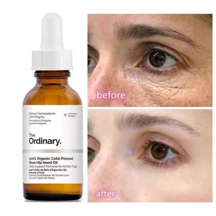 [THE ORDINARY] TINH CHẤT GIẢM QUẦNG THÂM, BỌNG MẮT THE ORDINARY CAFFEIN SOLUTION 5%+ EGCG | BigBuy360 - bigbuy360.vn