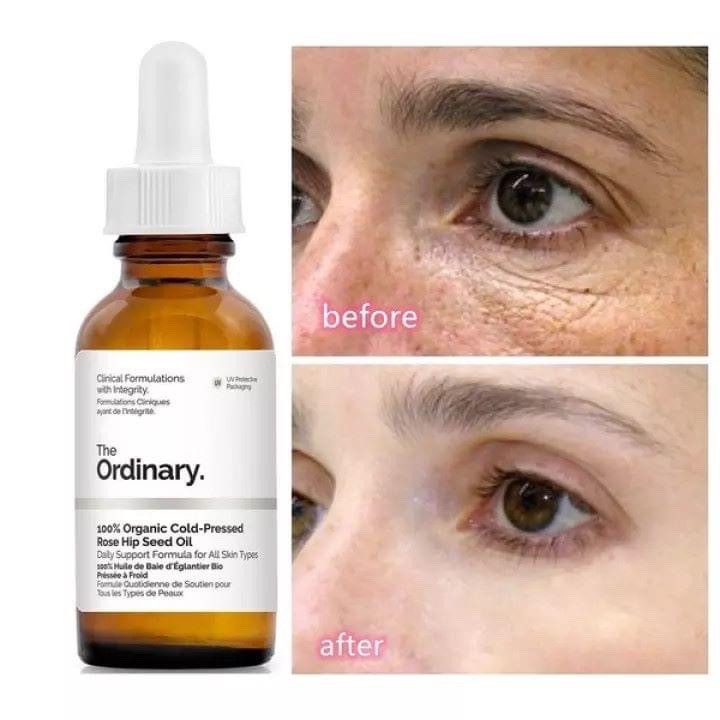 [THE ORDINARY] TINH CHẤT GIẢM QUẦNG THÂM, BỌNG MẮT THE ORDINARY CAFFEIN SOLUTION 5%+ EGCG