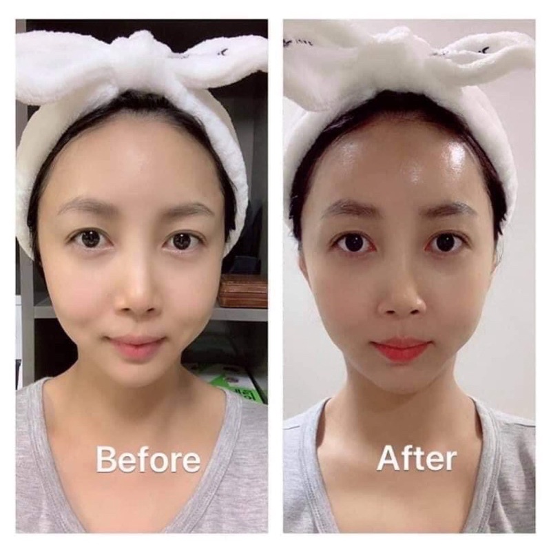 TINH CHẤT SÁNG DA CHỐNG LÃO HOÁ MEDI PEEL PEPTIDE 9 VOLUME BIO TOX PRO AMPOULE 100ML