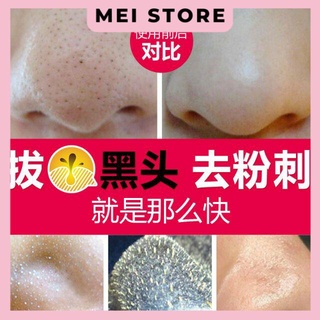 [Set 3 bước] Mặt nạ lột mụn đầu đen lớn BIOAQUA