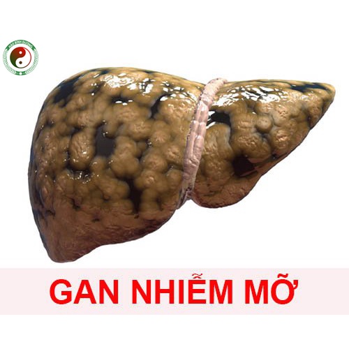 1kg Dược Liệu Tiêu Mỡ Giảm Cân - Giảm Mỡ Bụng