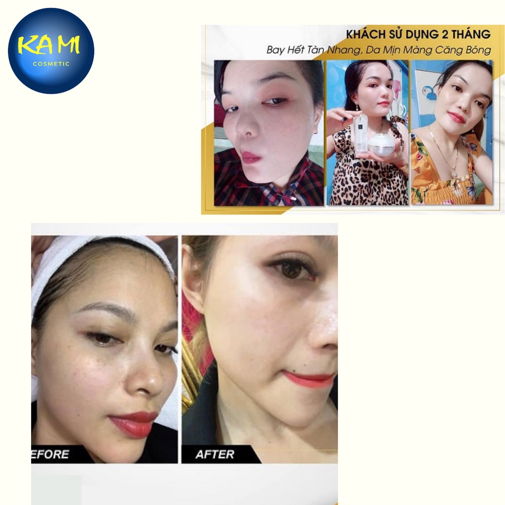 Kem dưỡng trắng da mặt face pháp chữ A 2022 chính hãng 50gr - KAMI - ngăn ngừa mụn, thâm nám tàn nhang, dưỡng ẩm