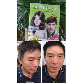Gội nhuộm SUPER NOVA Thái Lan