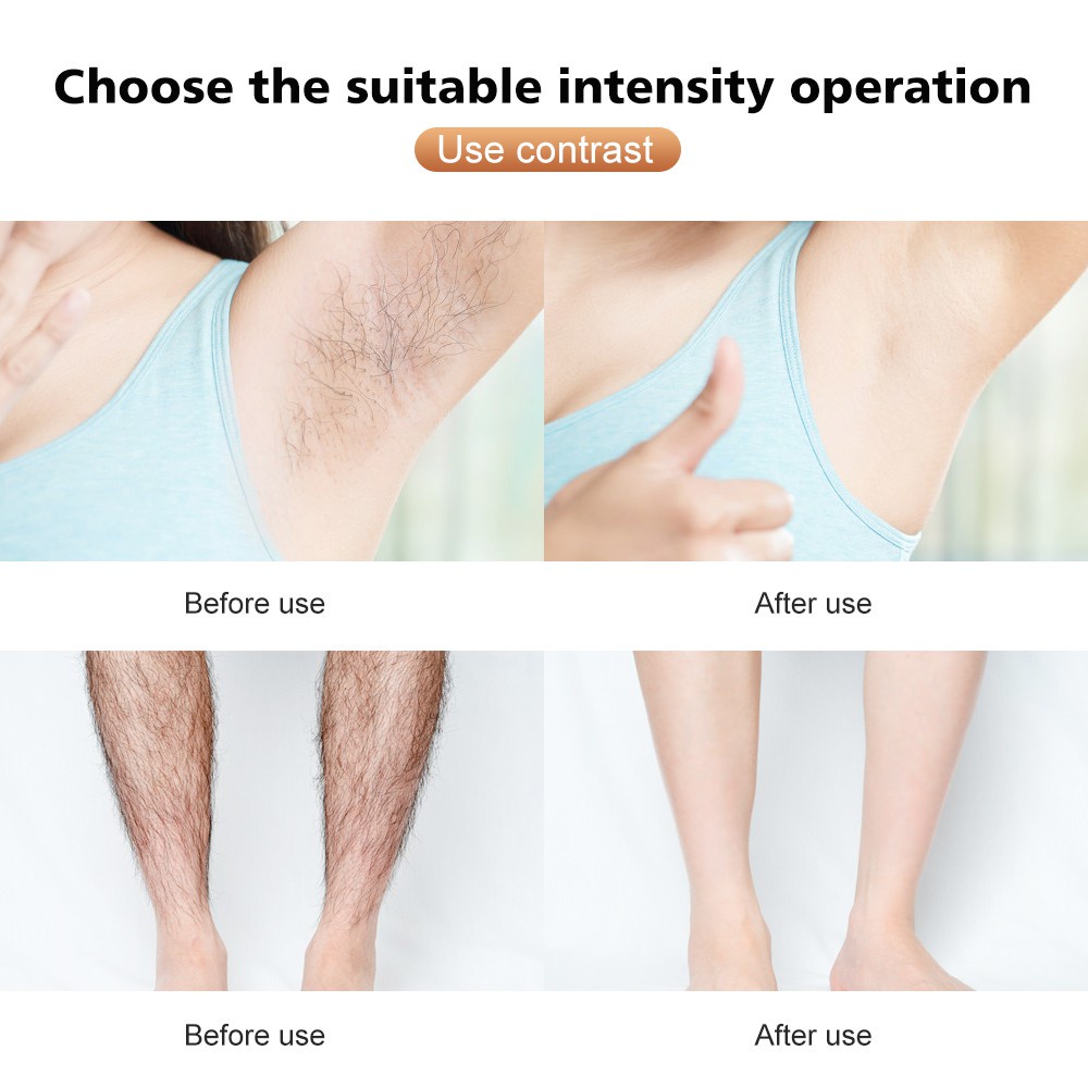 Ubeator Máy Tẩy Lông IPL Bằng laser Không Đau Chuyên Nghiệp Cho Nữ