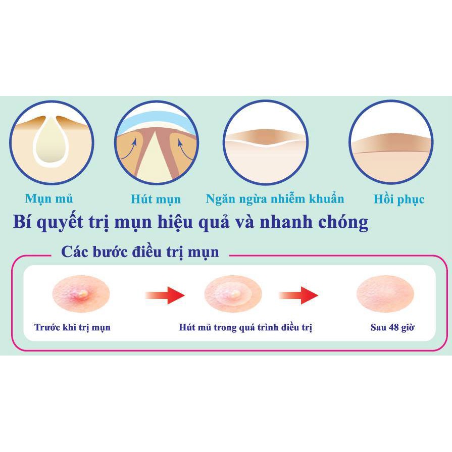 Miếng Dán giảm Mụn Mayan Care 20 Miếng (0.8cm)