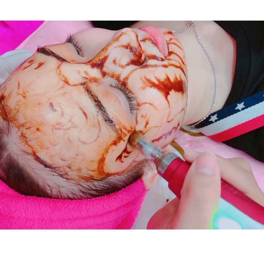 HCM  - Liệu trình căng bóng da: Cấy hồng sâm + Chiếu sáng sinh học + Điện di Vitamin C tại BEE Spa