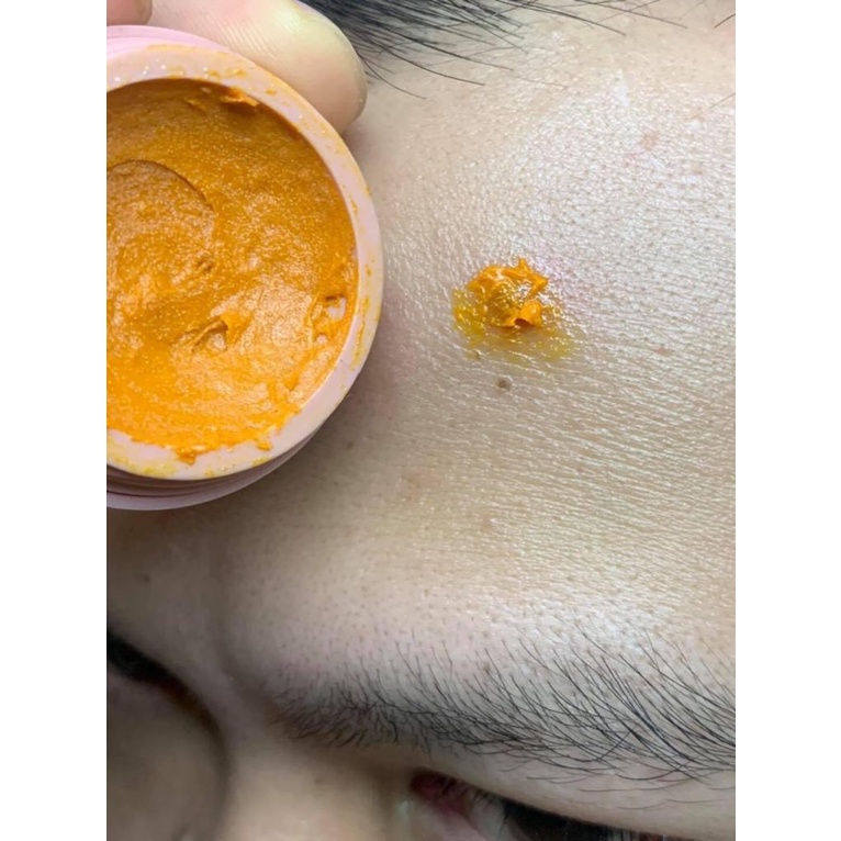 KEM MỤN KIM MỘC HOA - Kem Thâm Mụn