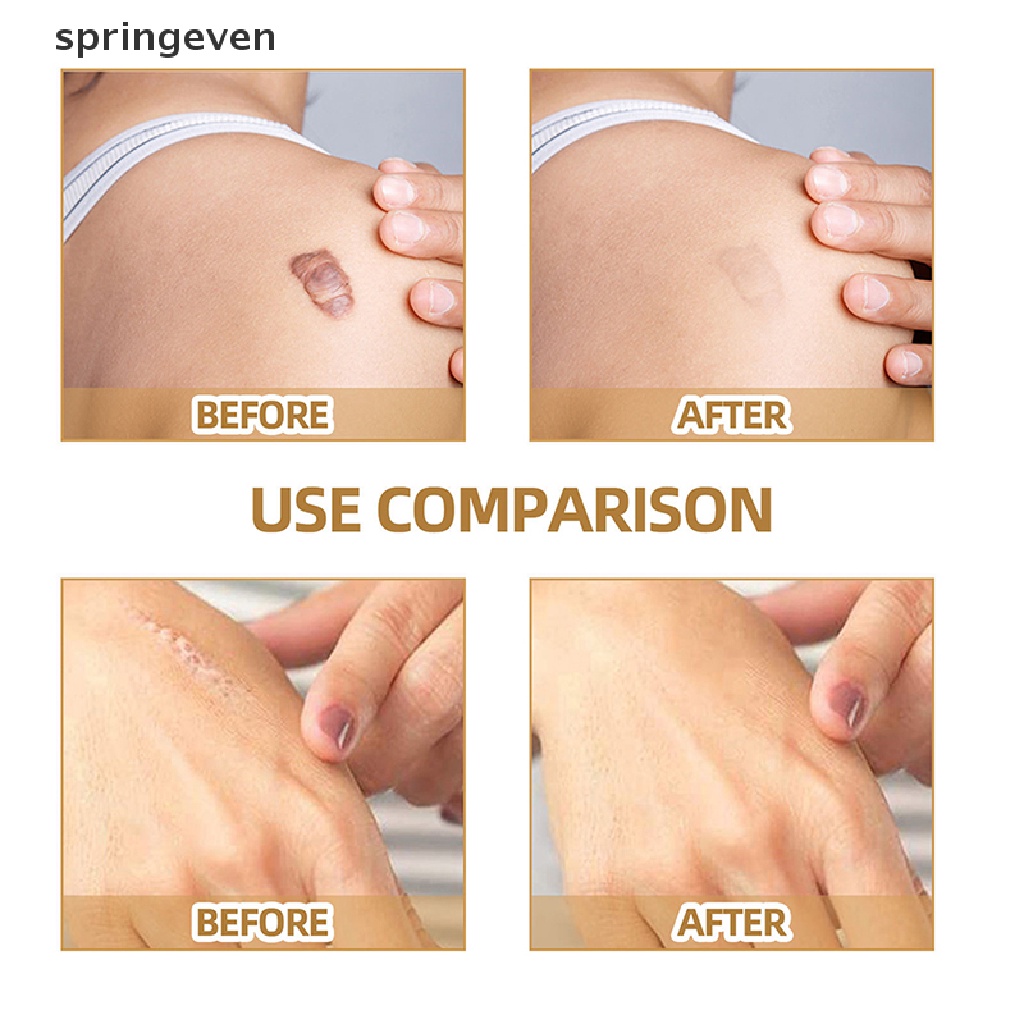 Bộ 60 Miếng Dán Che Khuyết Điểm Hình Xăm Chống Nước Che Phủ Mỏng