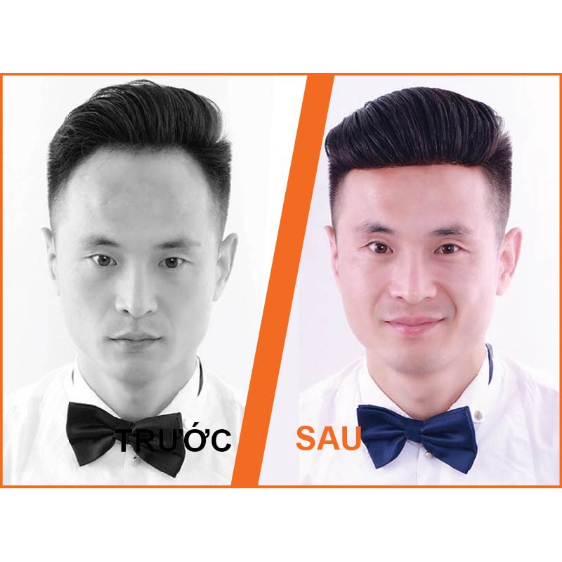 Tóc Giả Nam Chữ M-Miếng dán tóc giả nam cho người trán hói chữ M – màng Poly-MSP:808D-1 Miếng