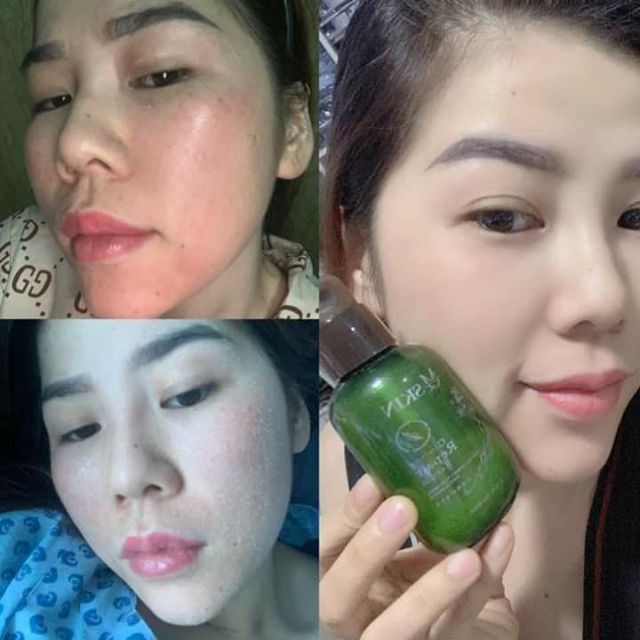 M-QSKIN NHÂN SÂM