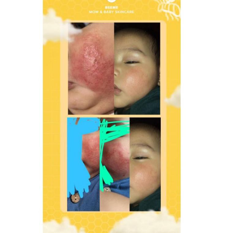 (Hàng Mới Về) Kem Dưỡng Da Tinh Chất Sáp Ong 22ma6bf Sup3R | BigBuy360 - bigbuy360.vn